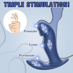 Wiggling & Vibrating Prostate Massager – App-Controlled Anal Plug for Men & Women