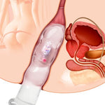 Vibrator Anal Beads Glowing Hands-Free Butt Plug Clear Vibrators for Prostate Massage and G-Spot Masturbation Adult Sex Toys for Men Women Couples (M)