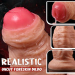 4.5'' Diameter Uncircumcised Thick Dildo, 10 Inch Dual Density Silicone Uncut Huge Dildos With Foreskin Butt Plug For Gay Men, Realistic Xxl Gaint Anal Dildos No Balls For P Spot Deeper Penetration