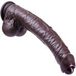 10.4-Inch Realistic Uncut Movable Foreskin Dildo, Silicone Huge Thick Dildo, Long Vaginal And Anal Xl Dildo,Big Suction Cup Black Dildo, Large Wide Dildo,Suitable For Men, Women,And Couples