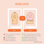 Phimorelief Stretching Rings– Set Of 20 Silicone Rings For Gentle Daily Use | Hypoallergenic, Reusable | Helps Support Natural Skin Flexibility | Phimosis