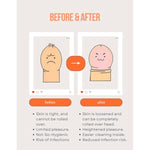 Causehuman Phimosis Stretching Rings Set (20 Rings) - Safe & Effective - Proven Results - Labelled Phimosis Rings - Free Stretching Tool