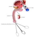 13.8" Flexible Stainless Steel Urethral Sounds Dilators Smooth Beads Urethral Dilator, Penis Plug Insert Prostate Stimulation Sounding Toys Catheter Stretching Male Masturbation Rod (6-8Mm)